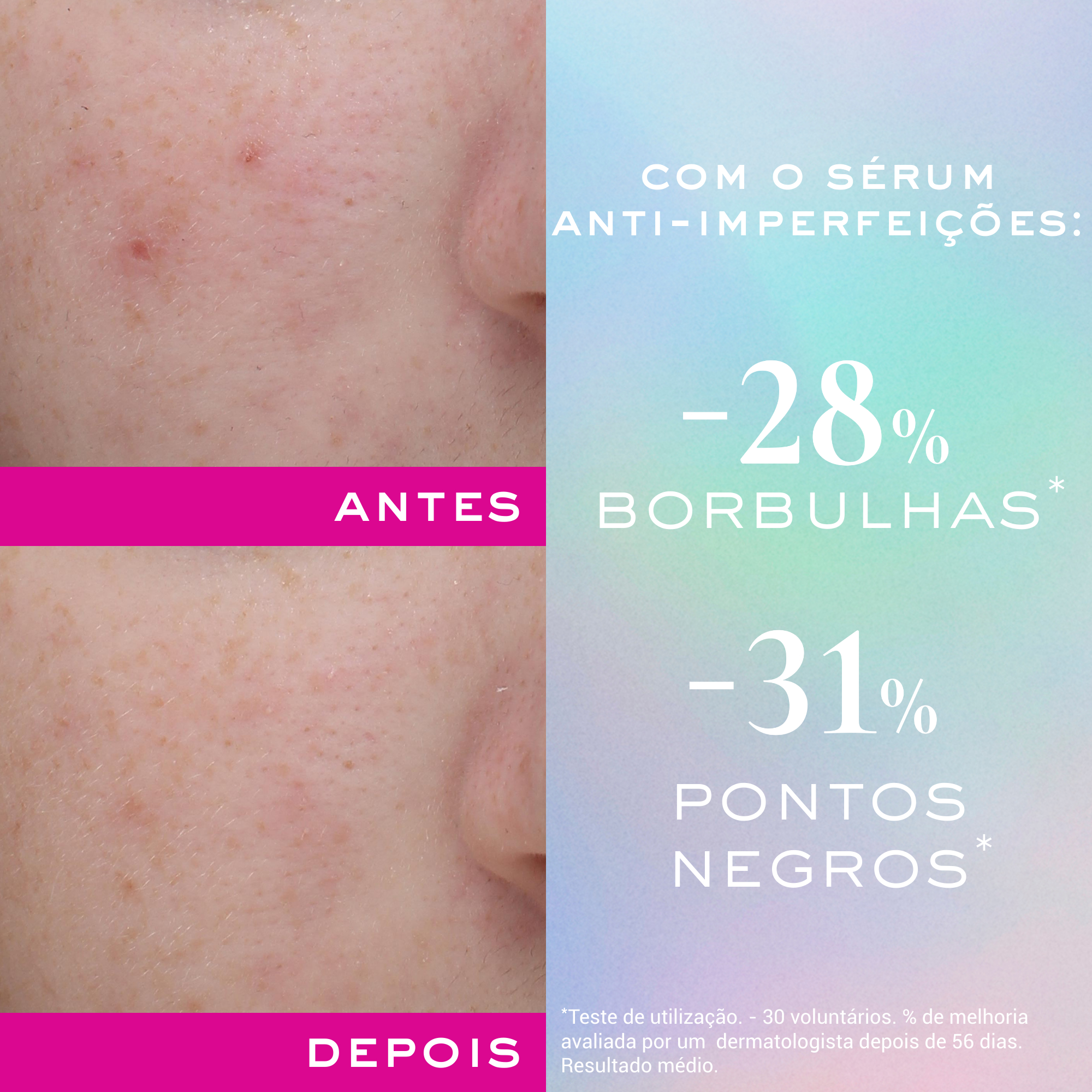 Nuxe Zinc Power Serum Anti Imperfeições 30ml